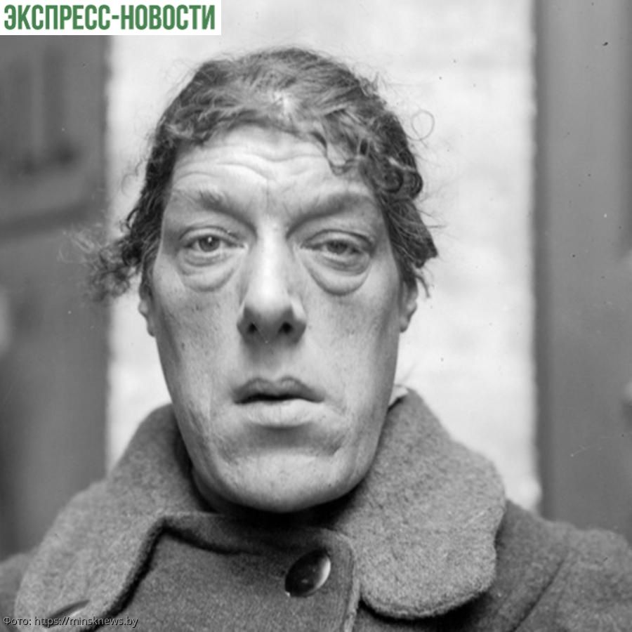 Мэри Энн Вебстер: непростая история жизни самой некрасивой женщины в мире